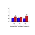 Effects of the Nootropic Compound Alpha BRAIN on ERP and EEG Measures of Cognitive Performance