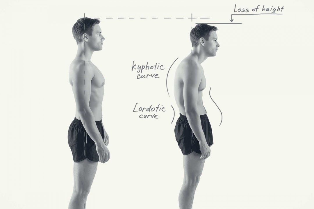 Correlations Between Your Pain Symptoms and Bad Posture