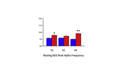 Effects of the Nootropic Compound Alpha BRAIN on ERP and EEG Measures of Cognitive Performance